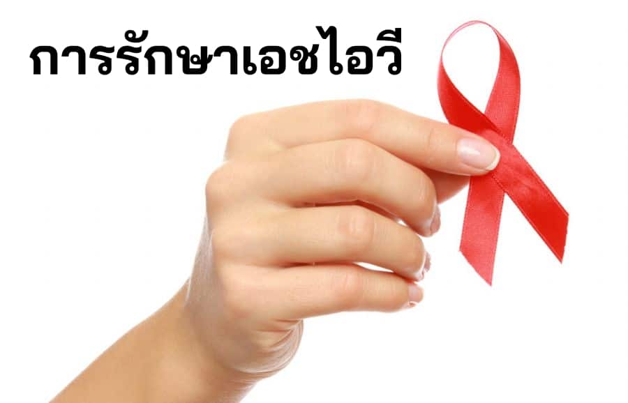 การรักษาเอชไอวี รักษา HIV รักษาเอดส์ โรคเอดส์ ไวรัสเอชไอวี ยาต้านไวรัสเอชไอวี ยาต้านเอดส์